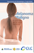 Melanoma